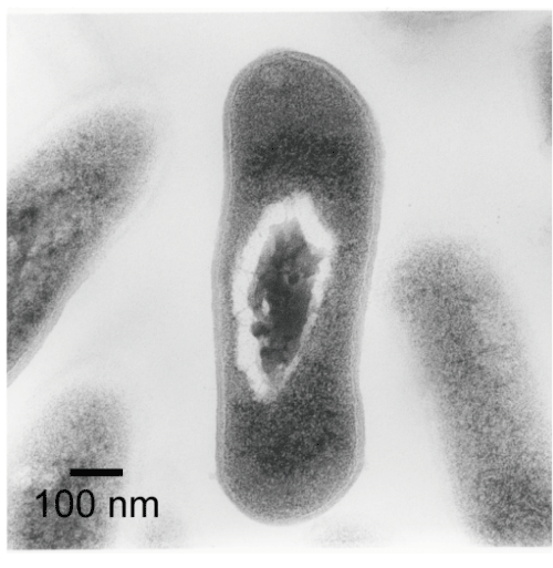 図5　Microbacterium lacticum細胞の透過電子顕微鏡像の写真。